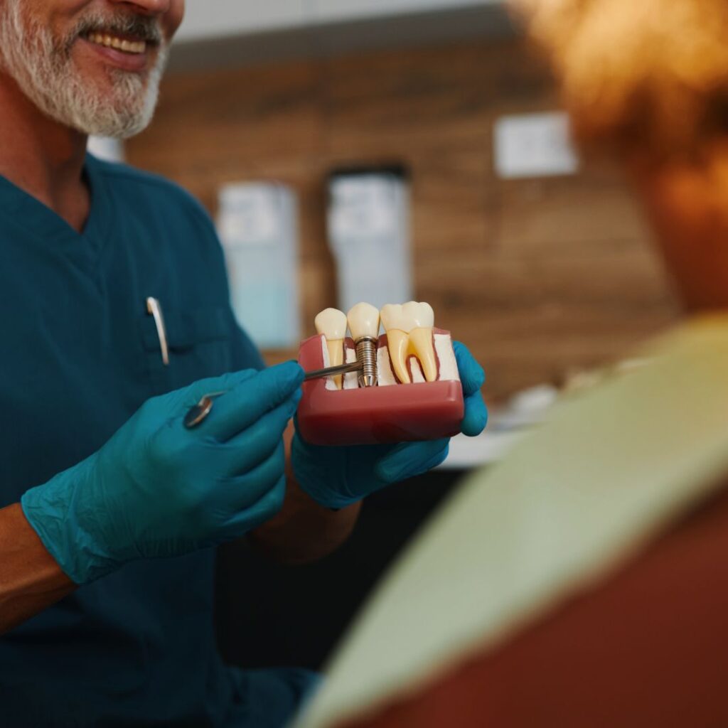 ¿Cuándo deberías optar por un tratamiento con implantes dentales?